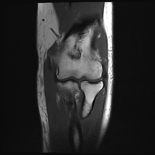 Click on the Serie image to view the images of Wieszt, Gnter